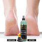 Pedi Spray Antiseptic, Mint & Eucalyptus - Refreshing Foot Care 16 oz